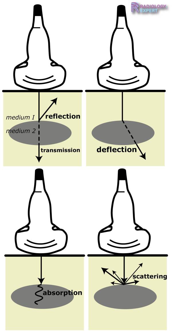 Ultrasound Technique